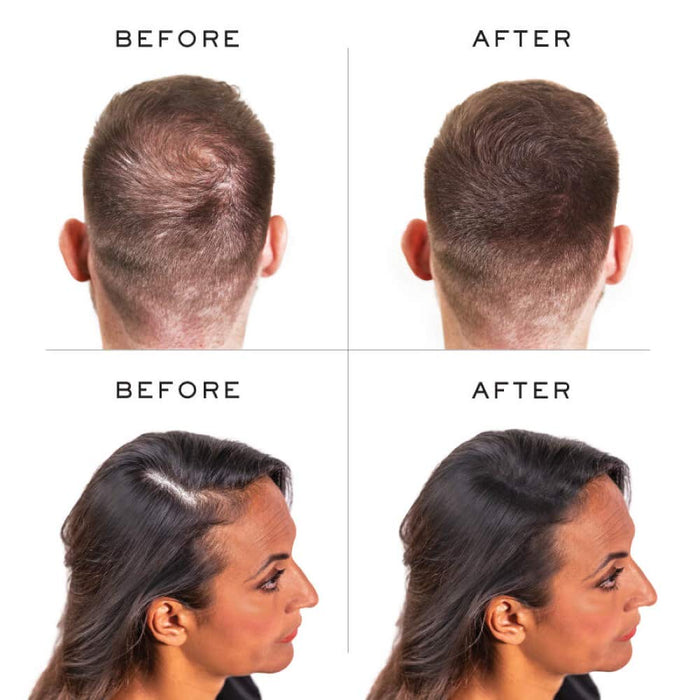 Nanogen Hair Thickening Keratin Fibres Light Brown